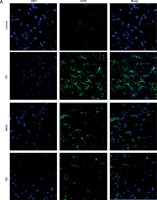 https://www.archivesofmedicalscience.com/f/fulltexts/113025/AMS-19-4-113025-g005_min.jpg