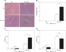 https://www.archivesofmedicalscience.com/f/fulltexts/113029/AMS-18-6-113029-g002_min.jpg