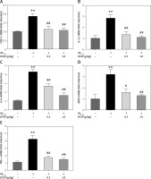 https://www.archivesofmedicalscience.com/f/fulltexts/113101/AMS-19-4-113101-g002_min.jpg