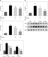 https://www.archivesofmedicalscience.com/f/fulltexts/113101/AMS-19-4-113101-g003_min.jpg