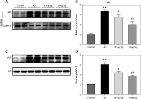 https://www.archivesofmedicalscience.com/f/fulltexts/113101/AMS-19-4-113101-g004_min.jpg