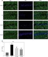 https://www.archivesofmedicalscience.com/f/fulltexts/113101/AMS-19-4-113101-g005_min.jpg