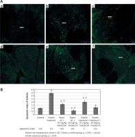 https://www.archivesofmedicalscience.com/f/fulltexts/113102/AMS-16-6-38461-g003_min.jpg