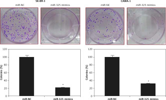 https://www.archivesofmedicalscience.com/f/fulltexts/113304/AMS-19-4-113304-g002_min.jpg