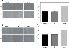 https://www.archivesofmedicalscience.com/f/fulltexts/113363/AMS-19-6-113363-g004_min.jpg