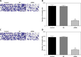 https://www.archivesofmedicalscience.com/f/fulltexts/113363/AMS-19-6-113363-g005_min.jpg