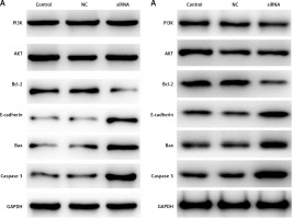 https://www.archivesofmedicalscience.com/f/fulltexts/113363/AMS-19-6-113363-g007_min.jpg