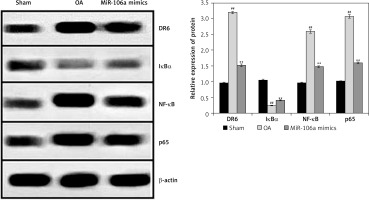 https://www.archivesofmedicalscience.com/f/fulltexts/113998/AMS-20-1-113998-g006_min.jpg