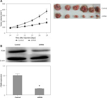 https://www.archivesofmedicalscience.com/f/fulltexts/114039/AMS-20-1-114039-g006_min.jpg