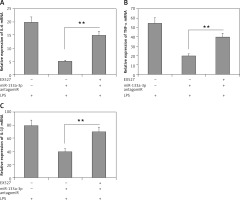 https://www.archivesofmedicalscience.com/f/fulltexts/114118/AMS-20-1-114118-g005_min.jpg