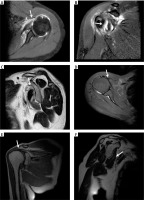 https://www.archivesofmedicalscience.com/f/fulltexts/114625/AMS-17-5-114625-g001_min.jpg