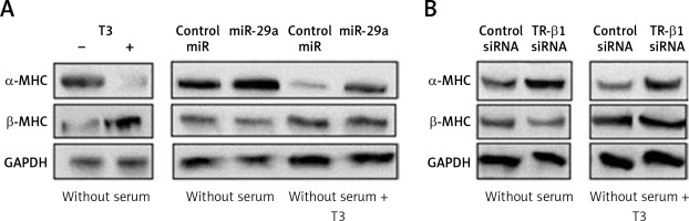 https://www.archivesofmedicalscience.com/f/fulltexts/114628/AMS-20-2-114628-g006_min.jpg