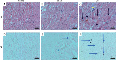 https://www.archivesofmedicalscience.com/f/fulltexts/114957/AMS-19-6-114957-g002_min.jpg