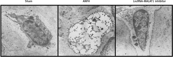 https://www.archivesofmedicalscience.com/f/fulltexts/115495/AMS-20-2-115495-g002_min.jpg