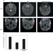https://www.archivesofmedicalscience.com/f/fulltexts/115495/AMS-20-2-115495-g003_min.jpg