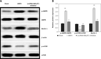 https://www.archivesofmedicalscience.com/f/fulltexts/115495/AMS-20-2-115495-g005_min.jpg