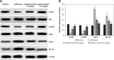 https://www.archivesofmedicalscience.com/f/fulltexts/116657/AMS-20-1-116657-g005_min.jpg