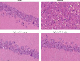 https://www.archivesofmedicalscience.com/f/fulltexts/116657/AMS-20-1-116657-g007_min.jpg