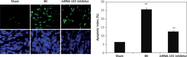 https://www.archivesofmedicalscience.com/f/fulltexts/117704/AMS-21-1-117704-g007_min.jpg
