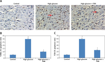 https://www.archivesofmedicalscience.com/f/fulltexts/118211/AMS-21-1-118211-g005_min.jpg