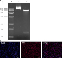 https://www.archivesofmedicalscience.com/f/fulltexts/118306/AMS-21-4-118306-g001_min.jpg