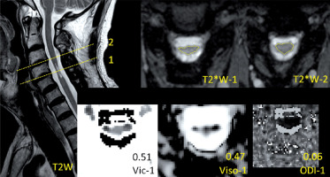 https://www.archivesofmedicalscience.com/f/fulltexts/118578/AMS-21-2-118578-g001_min.jpg