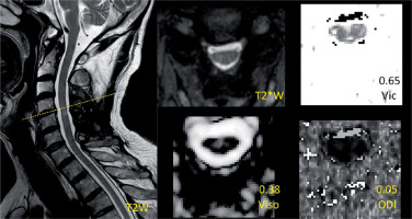 https://www.archivesofmedicalscience.com/f/fulltexts/118578/AMS-21-2-118578-g002_min.jpg