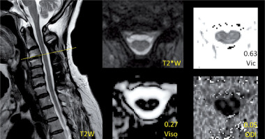 https://www.archivesofmedicalscience.com/f/fulltexts/118578/AMS-21-2-118578-g003_min.jpg