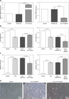 https://www.archivesofmedicalscience.com/f/fulltexts/118725/AMS-21-2-118725-g003_min.jpg