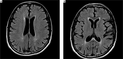 https://www.archivesofmedicalscience.com/f/fulltexts/118803/AMS-16-6-40491-g002_min.jpg