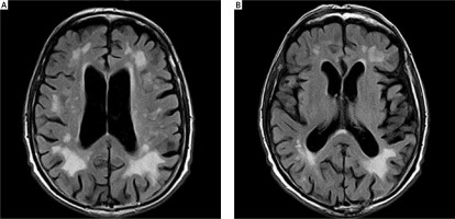 https://www.archivesofmedicalscience.com/f/fulltexts/118803/AMS-16-6-40491-g003_min.jpg