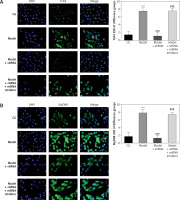https://www.archivesofmedicalscience.com/f/fulltexts/118804/AMS-21-2-118804-g010_min.jpg