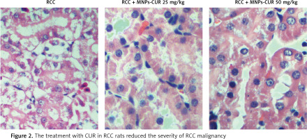 https://www.archivesofmedicalscience.com/f/fulltexts/118940/AMS-21-4-118940-g002_min.jpg
