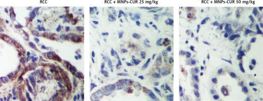 https://www.archivesofmedicalscience.com/f/fulltexts/118940/AMS-21-4-118940-g004_min.jpg