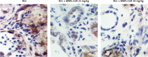 https://www.archivesofmedicalscience.com/f/fulltexts/118940/AMS-21-4-118940-g005_min.jpg