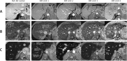 https://www.archivesofmedicalscience.com/f/fulltexts/119118/AMS-19-3-119118-g002_min.jpg