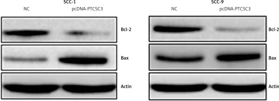 https://www.archivesofmedicalscience.com/f/fulltexts/119158/AMS-17-2-119158-g004_min.jpg