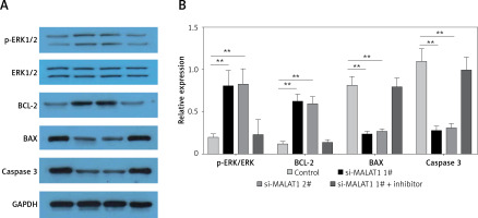 https://www.archivesofmedicalscience.com/f/fulltexts/119783/AMS-21-2-119783-g005_min.jpg