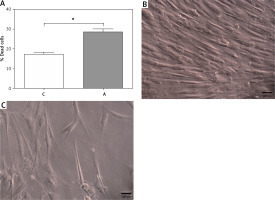 https://www.archivesofmedicalscience.com/f/fulltexts/119936/AMS-21-2-119936-g001_min.jpg