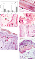 https://www.archivesofmedicalscience.com/f/fulltexts/119936/AMS-21-2-119936-g002_min.jpg