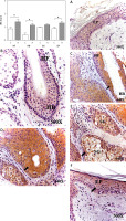 https://www.archivesofmedicalscience.com/f/fulltexts/119936/AMS-21-2-119936-g004_min.jpg