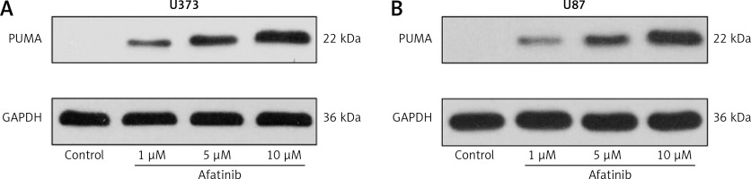 https://www.archivesofmedicalscience.com/f/fulltexts/119970/AMS-21-4-119970-g003_min.jpg