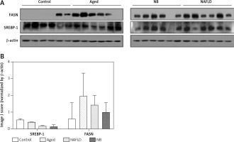 https://www.archivesofmedicalscience.com/f/fulltexts/120001/AMS-21-4-120001-g005_min.jpg