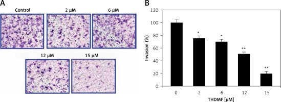 https://www.archivesofmedicalscience.com/f/fulltexts/121038/AMS-18-3-121038-g004_min.jpg