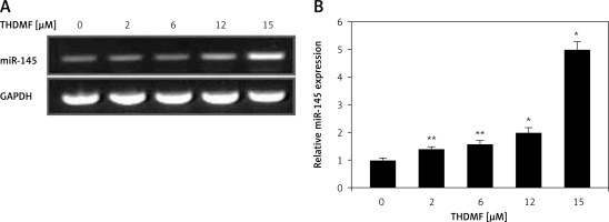 https://www.archivesofmedicalscience.com/f/fulltexts/121038/AMS-18-3-121038-g006_min.jpg