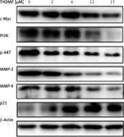 https://www.archivesofmedicalscience.com/f/fulltexts/121038/AMS-18-3-121038-g007_min.jpg