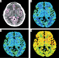 https://www.archivesofmedicalscience.com/f/fulltexts/122209/AMS-22-1-122209-g001_min.jpg