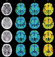 https://www.archivesofmedicalscience.com/f/fulltexts/122209/AMS-22-1-122209-g003_min.jpg