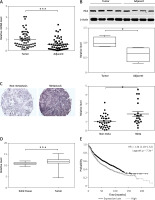 https://www.archivesofmedicalscience.com/f/fulltexts/122436/AMS-22-1-122436-g001_min.jpg