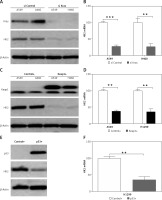 https://www.archivesofmedicalscience.com/f/fulltexts/122436/AMS-22-1-122436-g002_min.jpg
